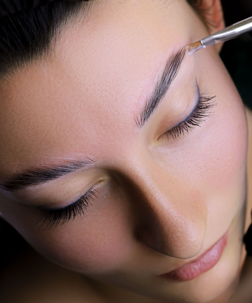 lifting-de-cejas-noanox